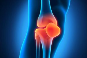 Лечение артроза: как проходит, особенности лечения